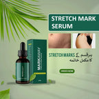Stretch Mark Serum - Anti-Aging & Whitening for Flawless Skin (1 Pcs) | Moon & Stars